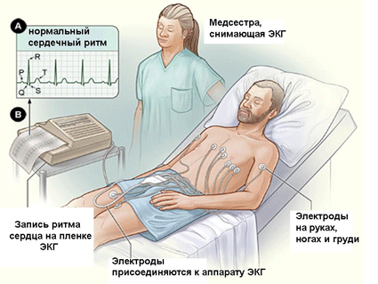 В чем суть электрокардиографии