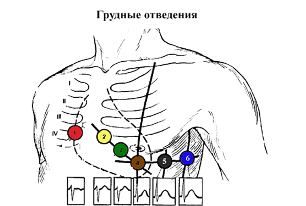 Грудные отведения