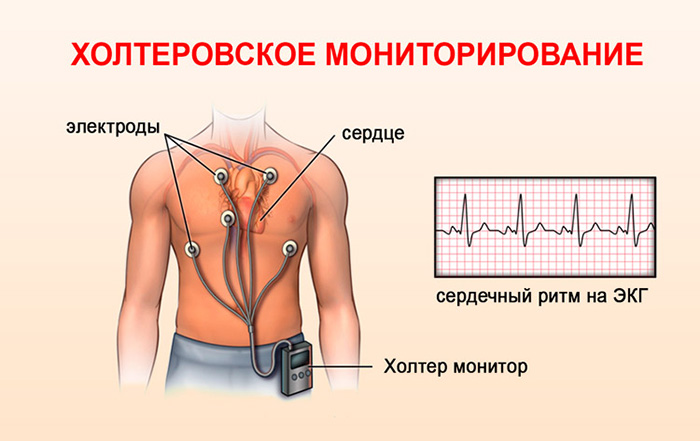 Регистрация ЭКГ по Холтеру